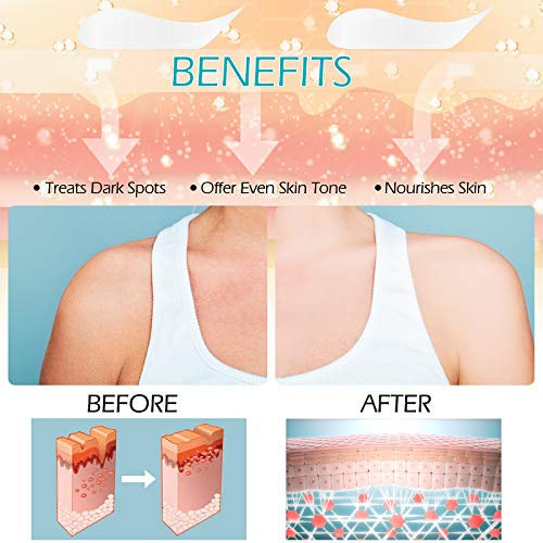 Brightening Cream, Dark Spot Cream Underarm